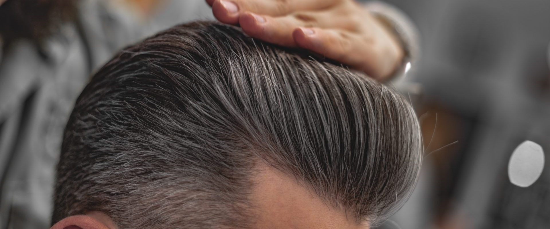 A man getting a hair transplant