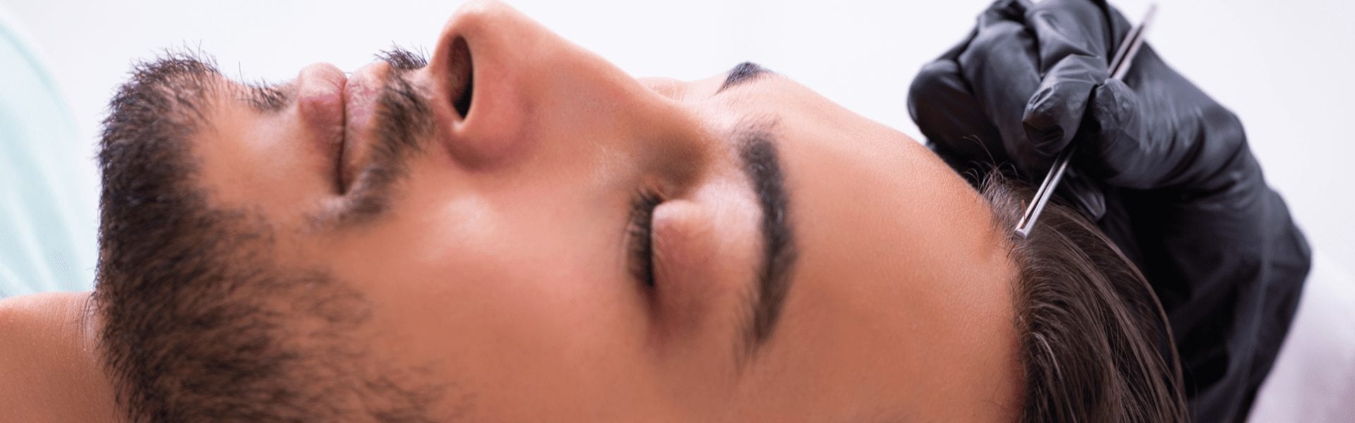 A man getting a hair restoration procedure