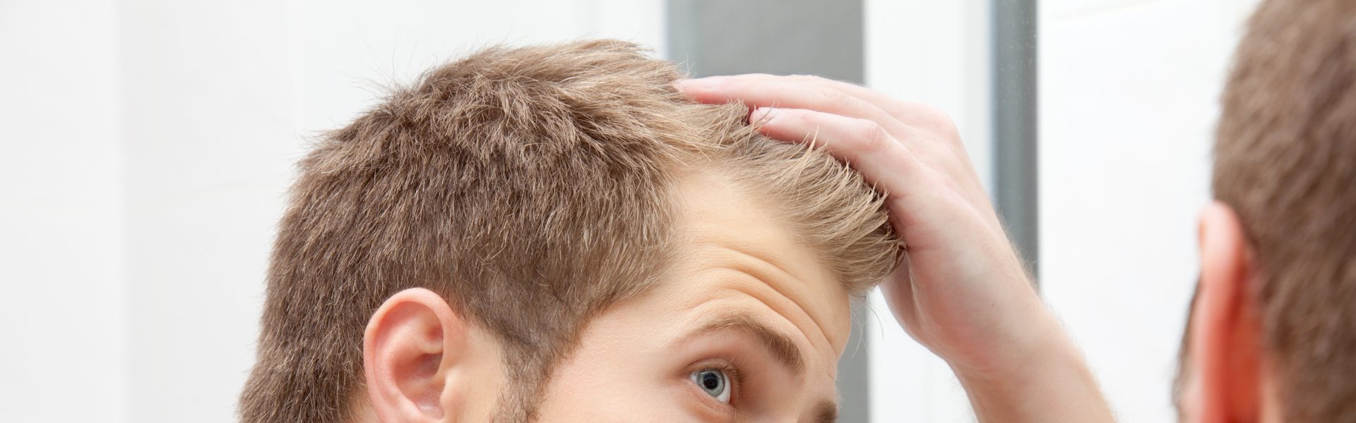 a man wondering if he is going bald, considering hair transplant