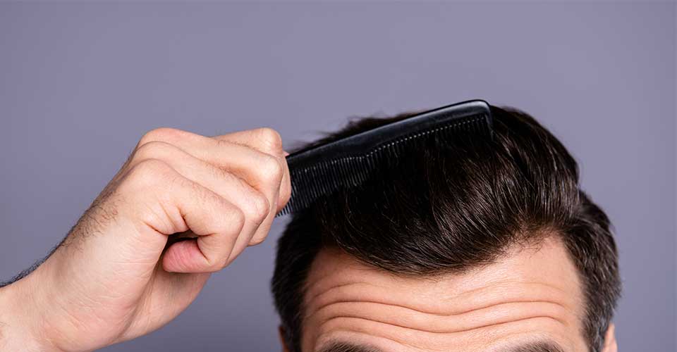 Man with full hair after hair transplant