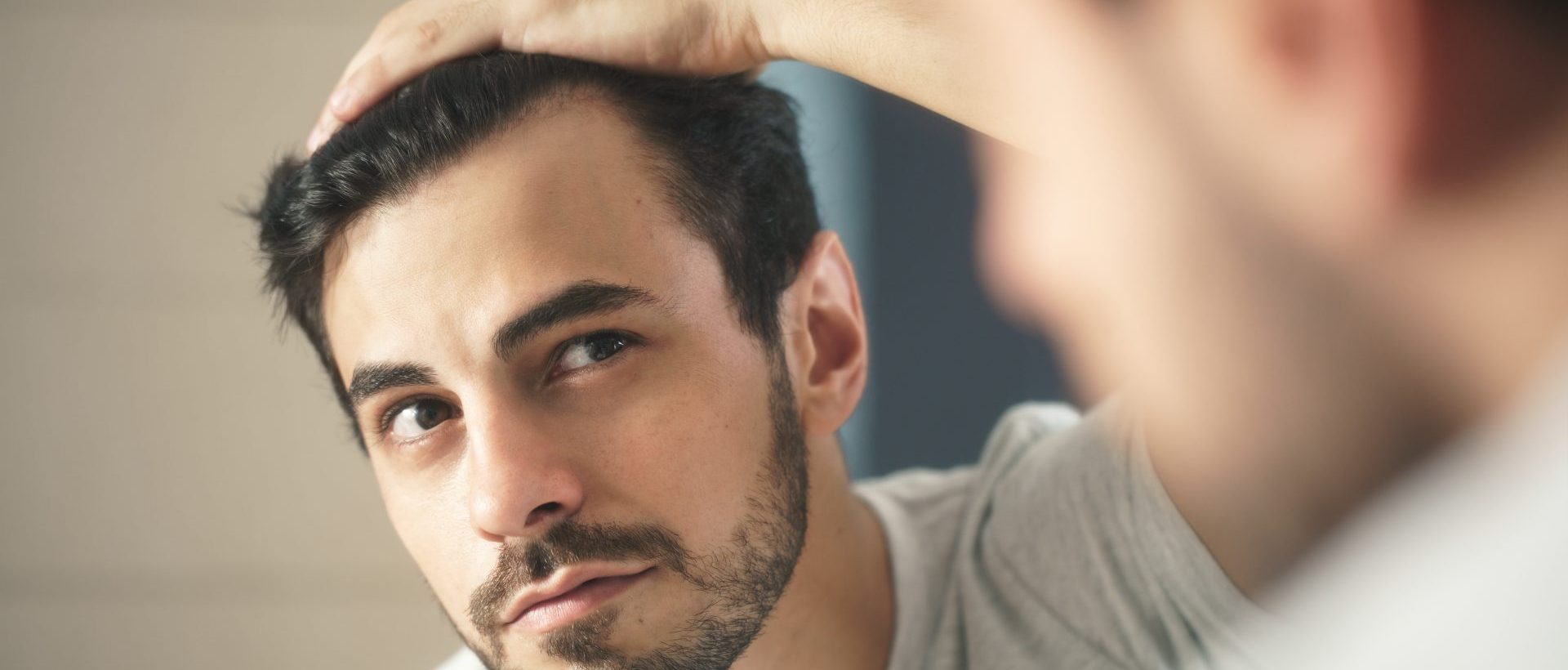 A man considering if hair transplants work