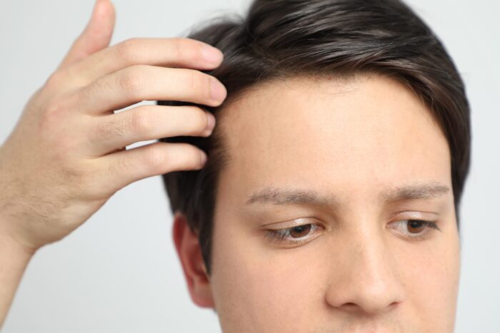 a man getting a hair restoration treatment