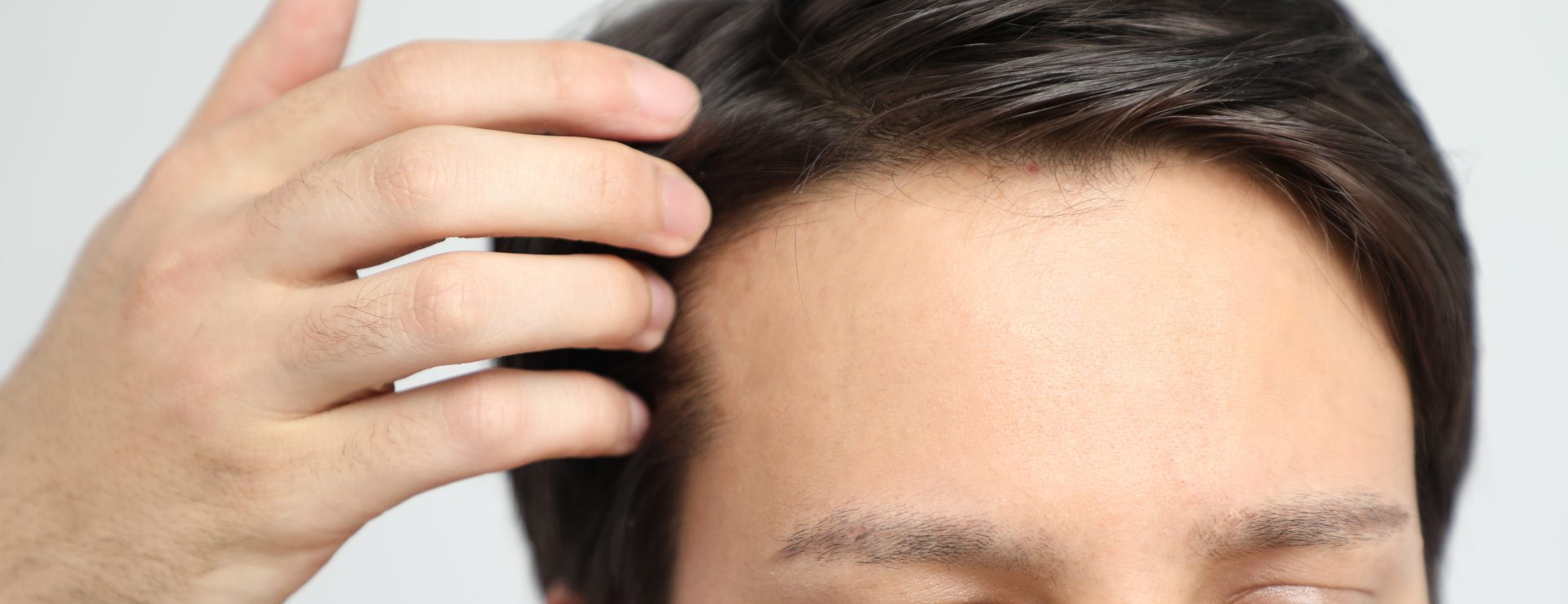 a man getting a hair restoration treatment