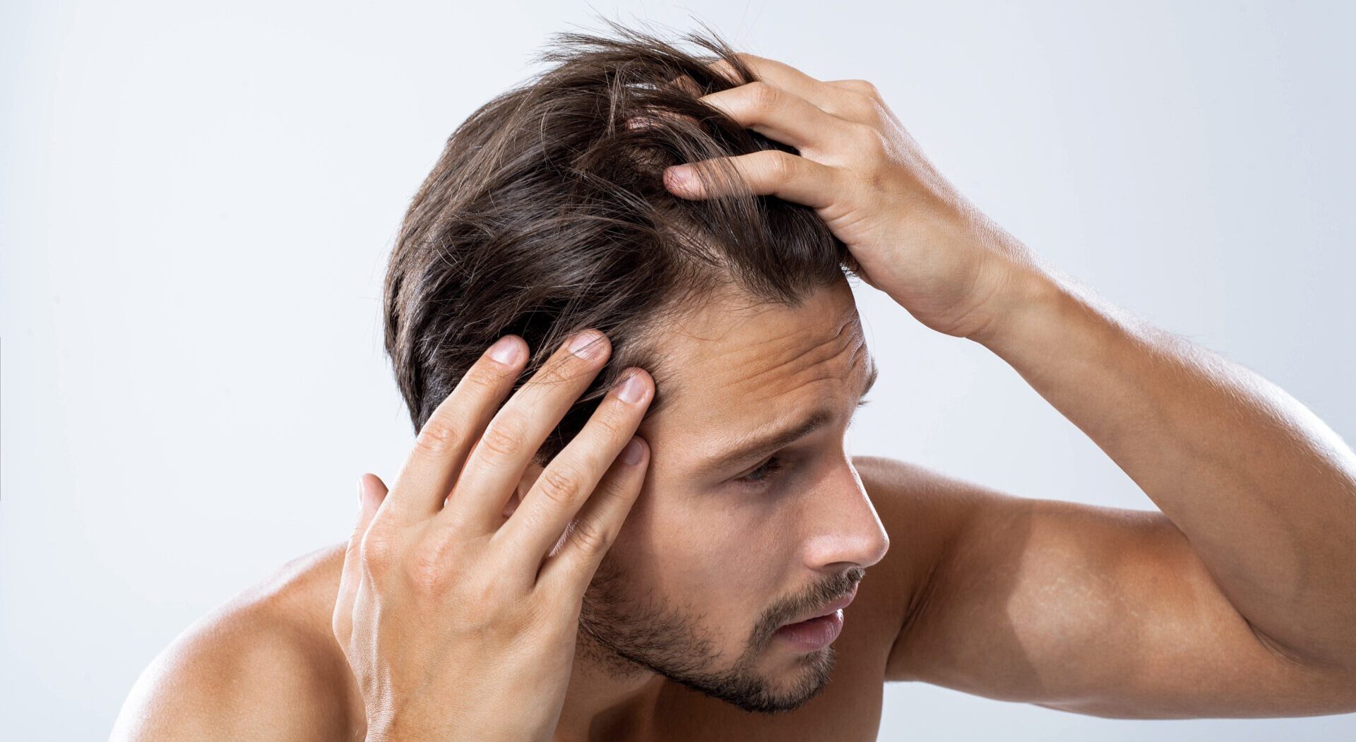 A man dealing with hair loss from stress